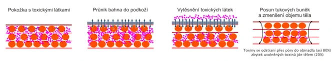 Schéma principu bahenního zábalu: pokožka s toxickými látkami, průnik bahna do podkoží, vytěsnění toxických látek a posun tukových buněk se zmenšením objemu těla